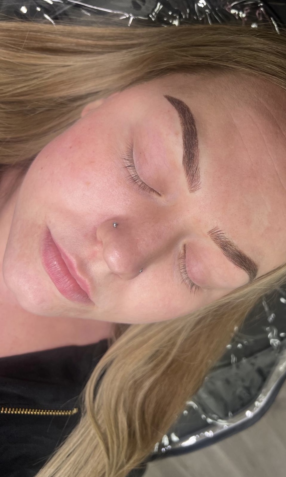 Brow result